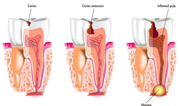 Endodonzia 1